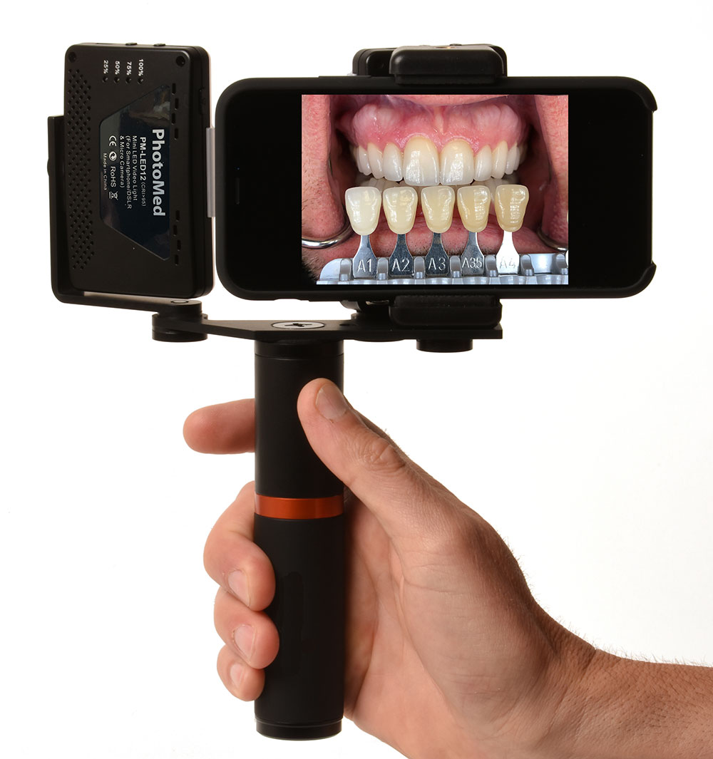 PhotoMed SDL - Smartphone Dental Light